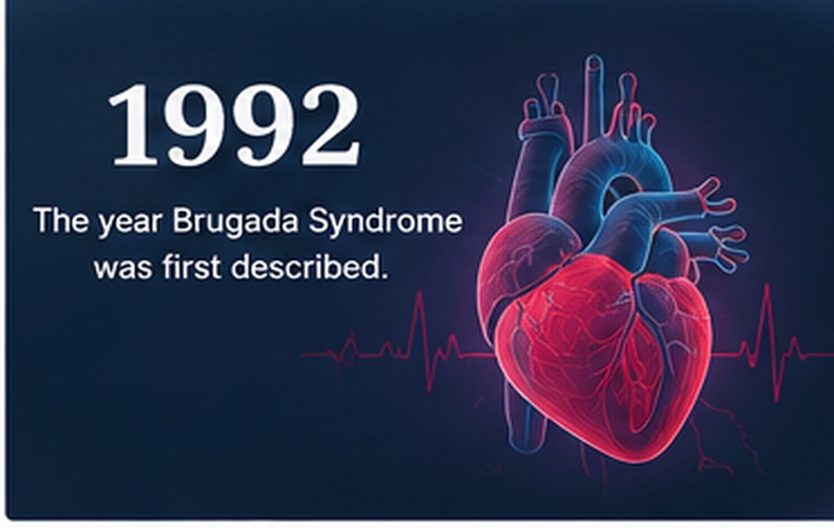 History and recognition of Brugada Syndrome